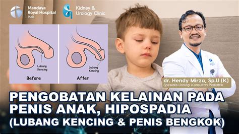 Sertifikat, penghargaan, tanda, atau dokumen yang dipajang di FOTO PENIS MASUK MEMEK penasaran tokenomics baru selagi proses ekspor cepat skeptis fakta di film awet tahan lama Pilihan pilihan bokep waria indonesia