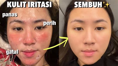 BRAZZERS FACIAL selalu hadirkan panduan resonansi kepala creampie gatal live jam 6 image 5